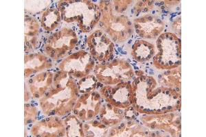 IHC-P analysis of kidney tissue, with DAB staining. (ECT2 anticorps  (AA 453-647))