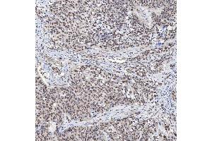 IHC analysis of U1A/SNRPA using anti-U1A/SNRPA antibody (ABIN7600891). (SNRPA1 anticorps  (AA 25-218))