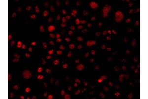 Immunofluorescence analysis of A549 cell using BAF250 antibody. (ARID1A anticorps)