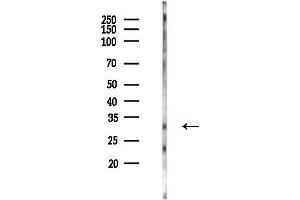 anti-Phenylethanolamine N-Methyltransferase (PNMT) (N-Term) antibody
