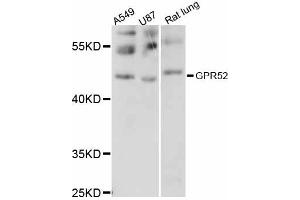 Western blot analysis of extracts of various cell lines, using GPR52 antibody (ABIN6292090) at 1:1000 dilution. (GPR52 anticorps)