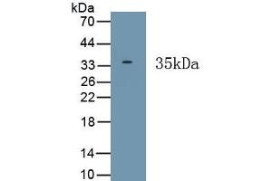 Detection of Recombinant HPS6, Human using Polyclonal Antibody to Hermansky Pudlak Syndrome Protein 6 (HPS6) (HPS6 anticorps  (AA 500-775))