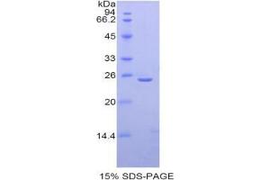 SDS-PAGE analysis of Mouse Thyroid Peroxidase Protein. (Thyroperoxidase Protéine)