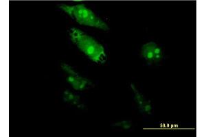 Immunofluorescence of monoclonal antibody to TGIF2 on HeLa cell.