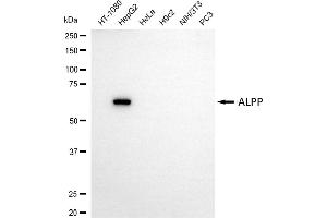 Western blotting analysis using ALPP antibody (ABIN7799842).