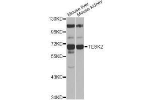 Western blot analysis of extracts of various cell lines, using TESK2 antibody (ABIN6292305) at 1:1000 dilution.