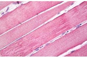 Image no. 1 for anti-Myosin X (MYO10) (Internal Region) antibody (ABIN1495955)