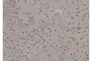 ABIN6257741 and ABIN6273591 at 1/100 staining Rat brain tissue by IHC-P.