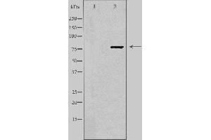 Western blot analysis of extracts from LOVO cells using FZD6 antibody. (FZD6 anticorps  (C-Term))