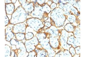 IHC testing of FFPE human placental tissue with recombinant Insulin Receptor alpha antibody (clone INSR/2277R). (ISR-alpha anticorps)