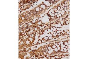 Immunohistochemical analysis of (ABIN1539214 and ABIN2838155) on paraffin-embedded human colon tissue was performed on the Leica®BOND RXm. (GATSL2 anticorps  (N-Term))
