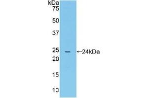 Western blot analysis of recombinant Mouse CYPD. (PPID anticorps  (AA 9-189))