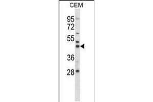Western blot analysis in CEM cell line lysates (35ug/lane). (MEK2 anticorps  (N-Term))