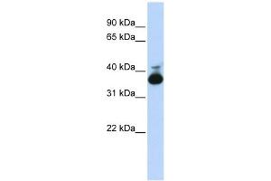 ALDOB antibody used at 1 ug/ml to detect target protein. (ALDOB anticorps  (Middle Region))