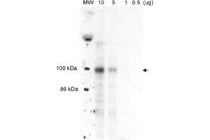 Western blot analysis of MLXIPL in liver nuclear extracts from well-fed rats. (MLXIPL anticorps  (AA 800-852))