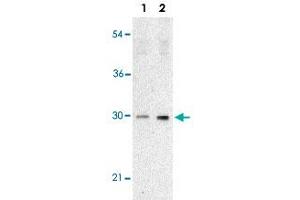 Western blot analysis of TP53INP1 expression in human lung tissue lysate with TP53INP1 polyclonal antibody  at 2 ug/mL in the absence (lane 1) or presence (lane 2) of blocking peptide. (TP53INP1 anticorps  (C-Term))
