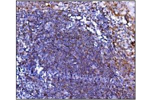 IHC analysis of Prolyl Endopeptidase/PREP using anti-Prolyl Endopeptidase/PREP antibody (ABIN7599118).
