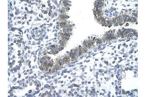 Rabbit Anti-CCRN4L antibody   Paraffin Embedded Tissue: Human Lung cell Cellular Data: bronchiole epithelium of renal tubule Antibody Concentration: 4.