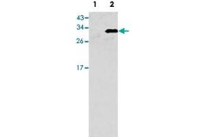 Western blot analysis of GJB6 (arrow) using GJB6 polyclonal antibody . (GJB6 anticorps  (N-Term))