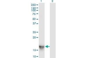 Western Blot analysis of SH2D1A expression in transfected 293T cell line by SH2D1A monoclonal antibody (M01), clone 1C9.