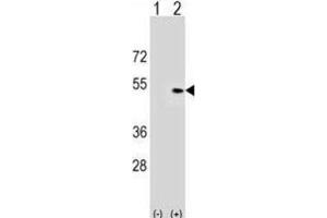 Western Blotting (WB) image for anti-Pleckstrin Homology Domain Containing, Family A (phosphoinositide Binding Specific) Member 1 (PLEKHA1) antibody (ABIN3000047) (PLEKHA1 anticorps)