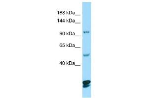 WB Suggested Anti-CTNND2 Antibody Titration: 1. (CTNND2 anticorps  (C-Term))