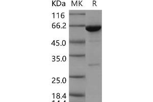Western Blotting (WB) image for Protein-tyrosine Phosphatase 1C (PTPN6) (AA 207-597) (Active) protein (GST tag,His tag) (ABIN7320120) (SHP1 Protein (AA 207-597) (GST tag,His tag))