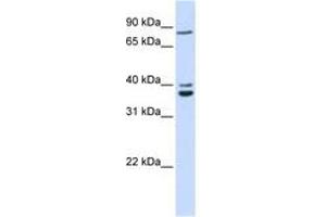 Image no. 1 for anti-Chromosome 18 Open Reading Frame 10 (C18orf10) (AA 108-157) antibody (ABIN6741301) (TPGS2 anticorps  (AA 108-157))