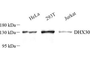 Western blot analysis of DHX30 (ABIN7073703) at dilution of 1: 250 (DHX30 anticorps)