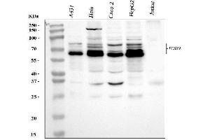 Western blot analysis of PCSK9 using anti-PCSK9 antibody (ABIN7600134).