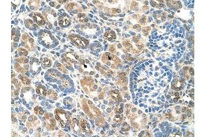 SLC22A16 antibody was used for immunohistochemistry at a concentration of 4-8 ug/ml to stain EpitheliaI cells of renal tubule (arrows) in Human Kidney.