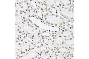 Immunohistochemistry of paraffin-embedded mouse kidney using Histone H1t Rabbit pAb (ABIN7267716) at dilution of 1:100 (40x lens).