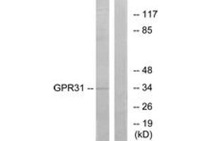 Western blot analysis of extracts from COLO cells, using GPR31 Antibody.