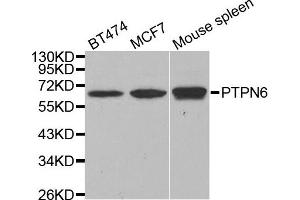 Western blot analysis of extracts of various cell lines, using PTPN6 antibody. (SHP1 anticorps)