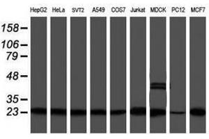 Image no. 12 for anti-Proteasome (Prosome, Macropain) Subunit, beta Type, 9 (Large Multifunctional Peptidase 2) (PSMB9) (AA 21-219) antibody (ABIN1491194)