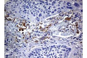 Image no. 1 for anti-Tyrosinase (TYR) (AA 19-320) antibody (ABIN1491083)