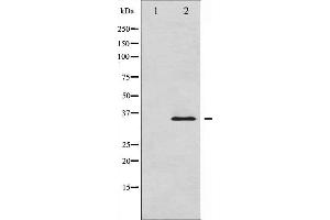 Western blot analysis of IkappaB-alpha expression in HuvEc whole cell lysates,The lane on the left is treated with the antigen-specific peptide. (NFKBIA anticorps  (C-Term))