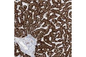 Immunohistochemical staining of human liver with PID1 polyclonal antibody  shows strong cytoplasmic positivity in hepatocytes. (PID1 anticorps)