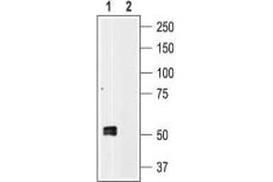 Western blot analysis of human platelet lysates: - 1.