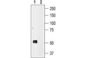 Western blot analysis of human platelet lysates: - 1. (P2RX1 anticorps  (C-Term, Intracellular))