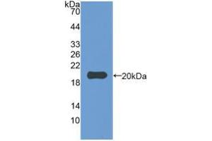 Western blot analysis of recombinant Rabbit IL1b. (IL-1 beta anticorps  (AA 118-268))