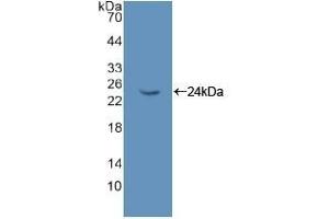 Detection of Recombinant NME6, Rat using Polyclonal Antibody to Non Metastatic Cells 6, Protein Expressed In (NME6) (Non Metastatic Cells 6, Protein Expressed In (AA 1-173) anticorps)