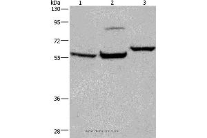 Western blot analysis of Mouse brain tissue, 231 and Hela cell, using ESR1 Polyclonal Antibody at dilution of 1:200 (Estrogen Receptor alpha anticorps)
