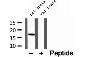 Western blot analysis of extracts of rat brain tissue, using CPLX1 antibody.