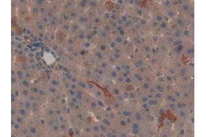 Used in DAB staining on fromalin fixed paraffin- embedded kidney tissue (SHBG anticorps  (AA 222-358))