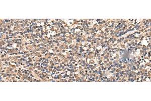 Immunohistochemistry of paraffin-embedded Human tonsil tissue using ZSCAN12 Polyclonal Antibody at dilution of 1:50(x200) (ZSCAN12 anticorps)