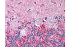 Anti-KCNJ6 / GIRK2 antibody IHC of human brain, cerebellum.