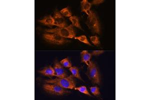 Immunofluorescence analysis of C6 cells using ACHE Rabbit pAb (ABIN3016742, ABIN3016743, ABIN3016744 and ABIN6219831) at dilution of 1:100. (Acetylcholinesterase anticorps  (AA 398-617))