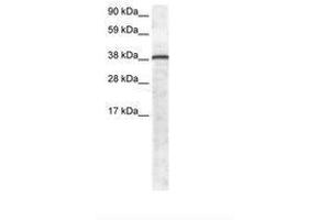 Image no. 1 for anti-Growth Factor Independent 1 (GFI1) (AA 32-81) antibody (ABIN6735896) (GFI1 anticorps  (AA 32-81))