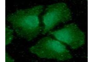 ICC/IF analysis of CIB1 in HeLa cells line, stained with DAPI (Blue) for nucleus staining and monoclonal anti-human CIB1 antibody (1:100) with goat anti-mouse IgG-Alexa fluor 488 conjugate (Green). (CIB1 anticorps)